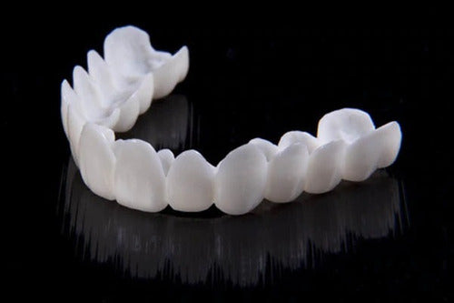 Charly | DentAlign Dental Veneers – Natural Fit and Comfort