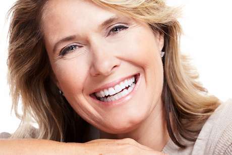 Charly | DentAlign Dental Veneers – Natural Fit and Comfort