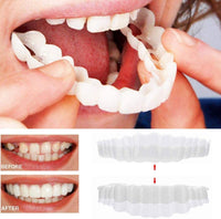 Sisica | On Smile Veneers (Upper and Lower Jaw included)