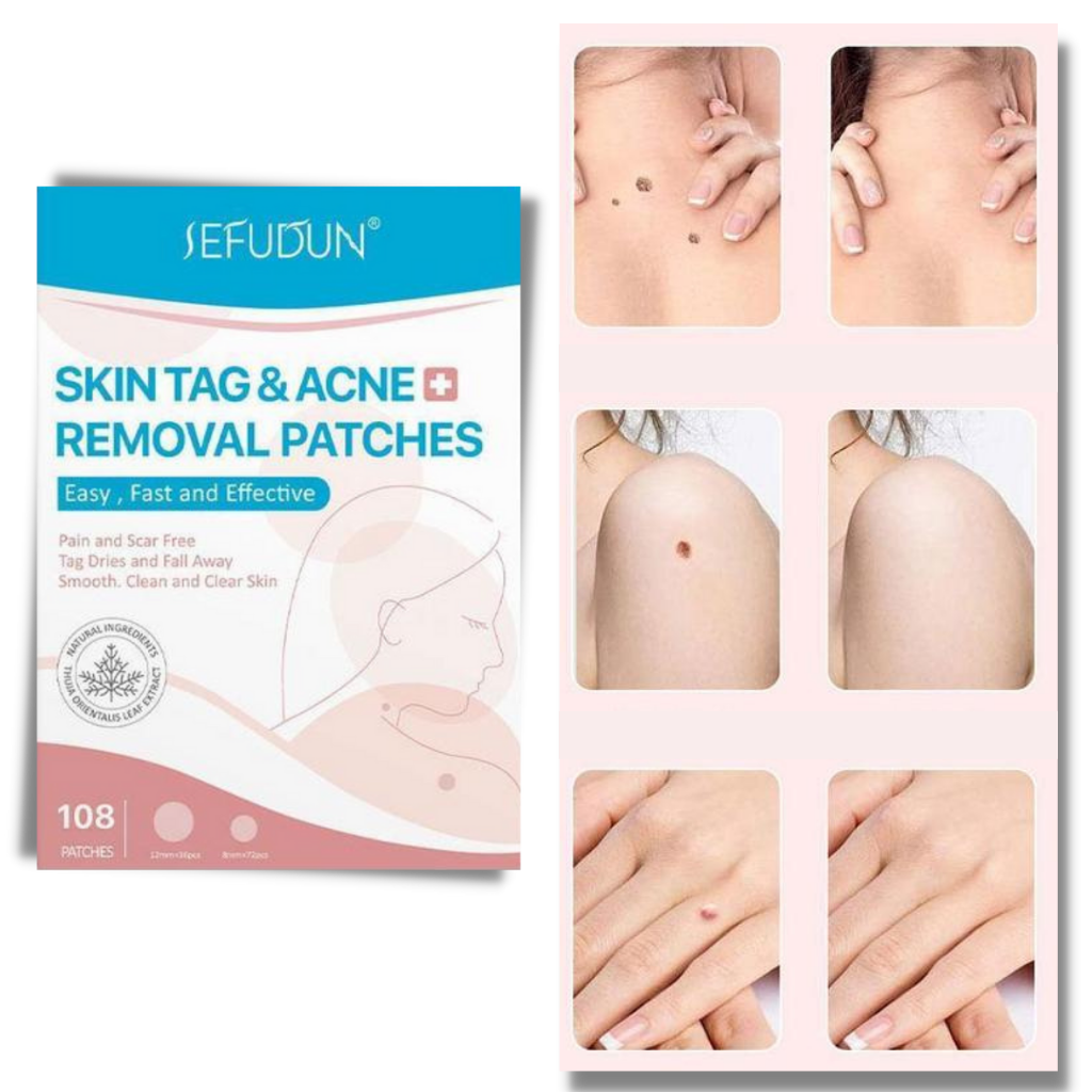 Charly | Skin Patch - Remove Moles and Warts Naturally!