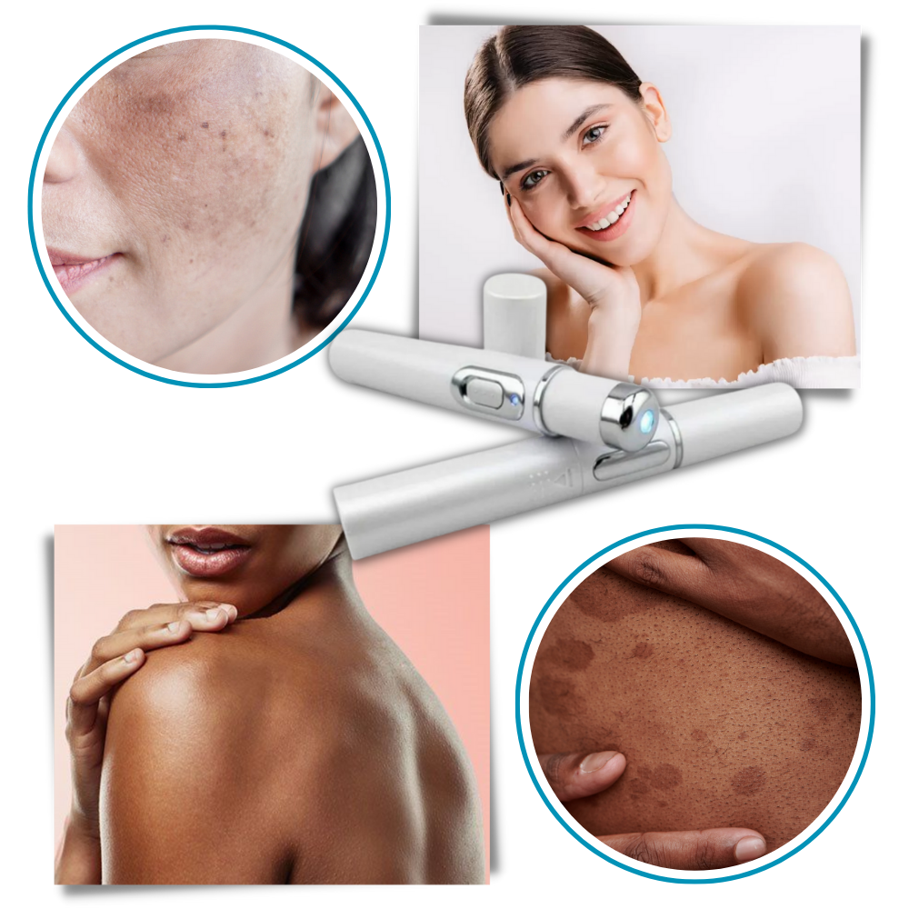 DermaPure | Portable Laser Therapy for a Brighter Complexion