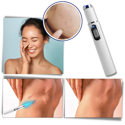 DermaPure | Portable Laser Therapy for a Brighter Complexion