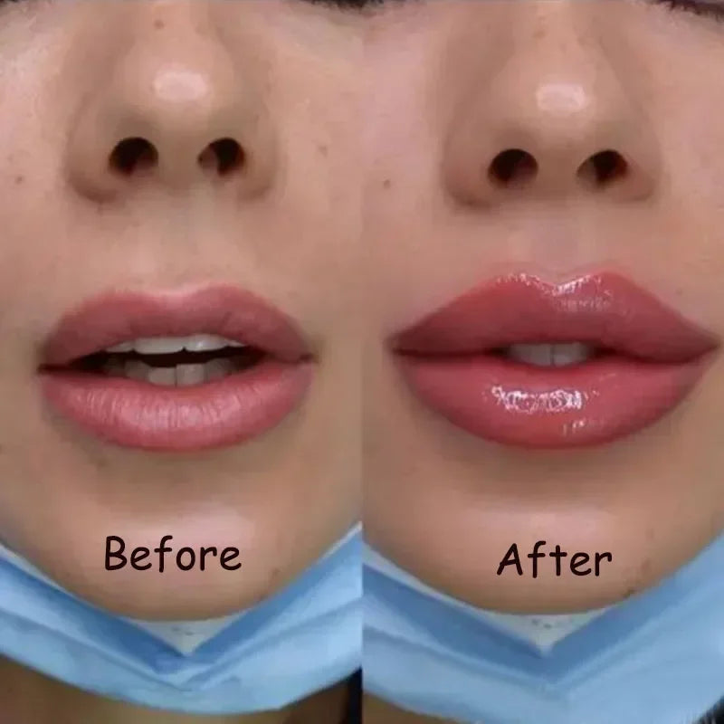 Instant Lip Plumping Serum