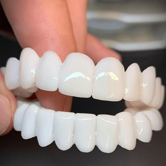 SMILEFLEX – Dental Prosthesis with White Dental Lenses