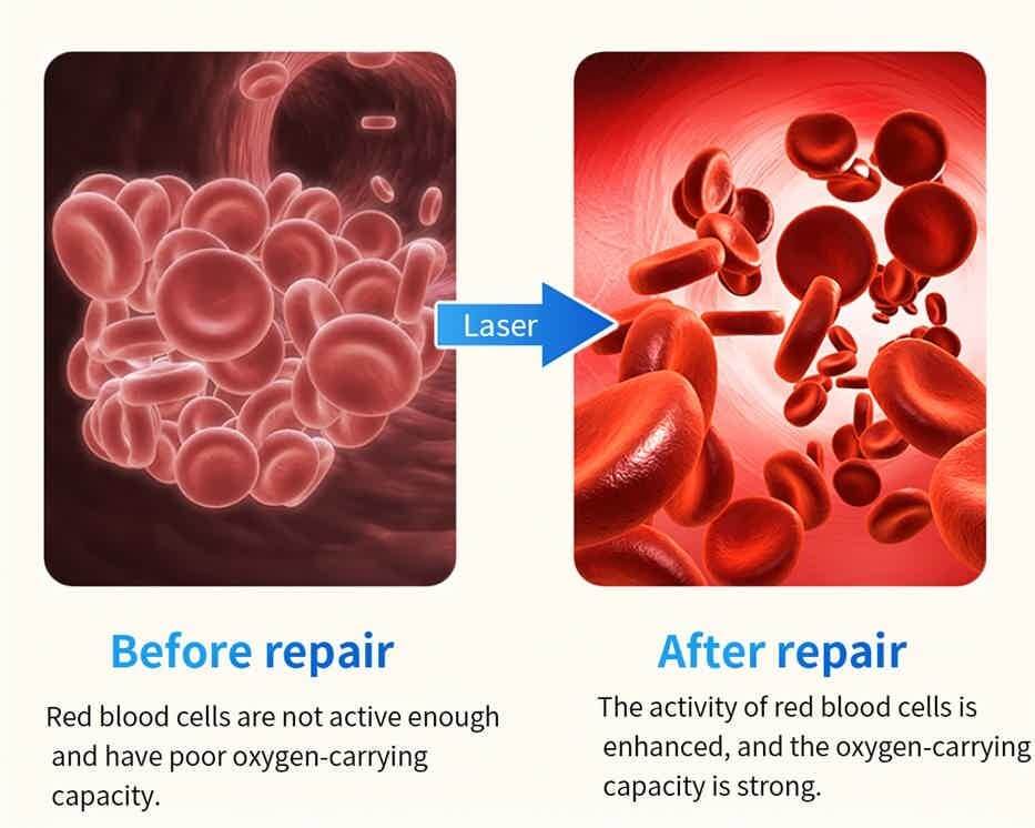 VitaSense Wellness Glucose Watch Noninvasive Monitor